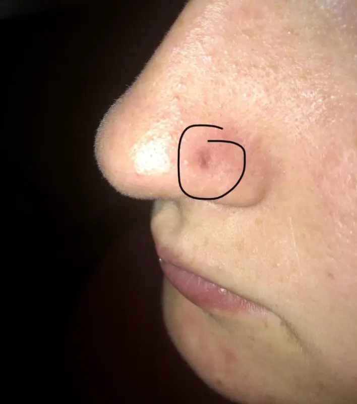 Closed Nose Piercing